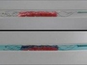 Tin tức - Cứu sống bệnh đôt quỵ não bằng phương pháp mới