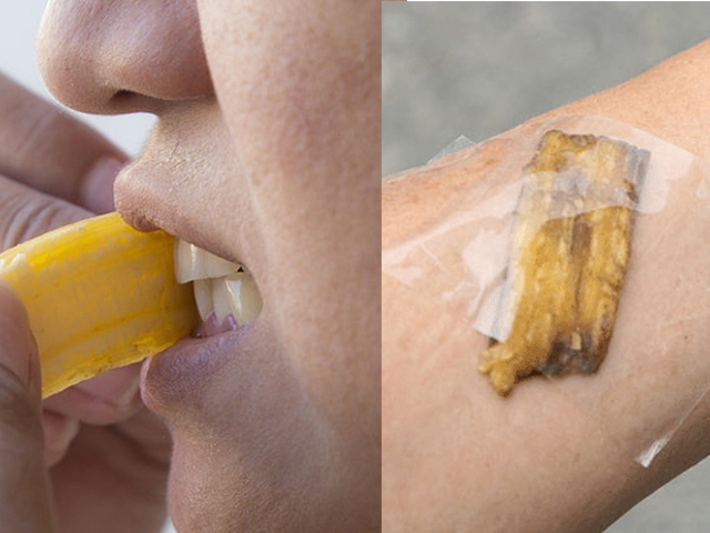 Đừng vứt vỏ chuối vào thùng rác khi biết 5 công dụng làm đẹp diệu kỳ này