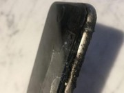 Tin tức - Bỏng cấp độ 3 do iPhone 6 bỗng nhiên phát nổ trong túi quần
