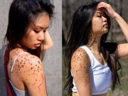 Làm đẹp - Vượt qua dị nghị, cô gái có làn da báo đốm ngày càng xinh đẹp