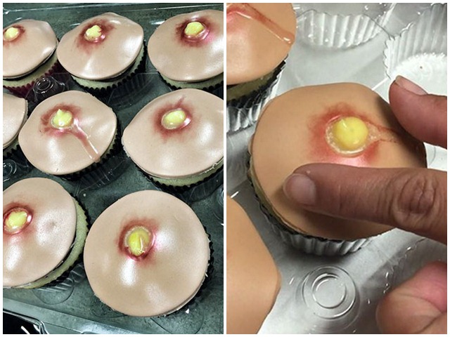 Sởn da gà với những chiếc bánh cupcake hình mụn nhọt