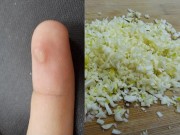 Làm đẹp - Trị mụn cóc cứng đầu bằng vài nhánh tỏi, bạn đã biết chưa?