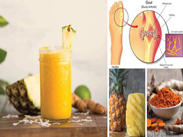 Đồ uống tốt cho người mắc bệnh gút