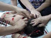 Tin tức - Những chiếc kim 'thần kỳ' khiến người câm biết nói, trẻ bị liệt biết đi