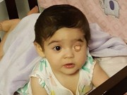 Làm mẹ - Bé gái sinh ra với đôi mắt kỳ lạ vẫn khiến nhiều người xiêu lòng vì xinh xắn