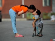 Eva Yêu - Chuyện tình cổ tích của chú lùn 80cm và người vợ với gương mặt biến dạng