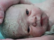 Làm mẹ - Đôi mắt ám ảnh của bé sơ sinh chào đời từ bụng người mẹ hôn mê