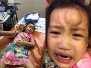 Làm mẹ - Ốc Thanh Vân hốt hoảng với khuôn mặt có cục sưng “to như quả ổi” của con gái