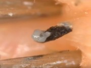 Làm đẹp - Clip nặn mụn đầu đen thu hút hàng triệu lượt xem chỉ trong một ngày