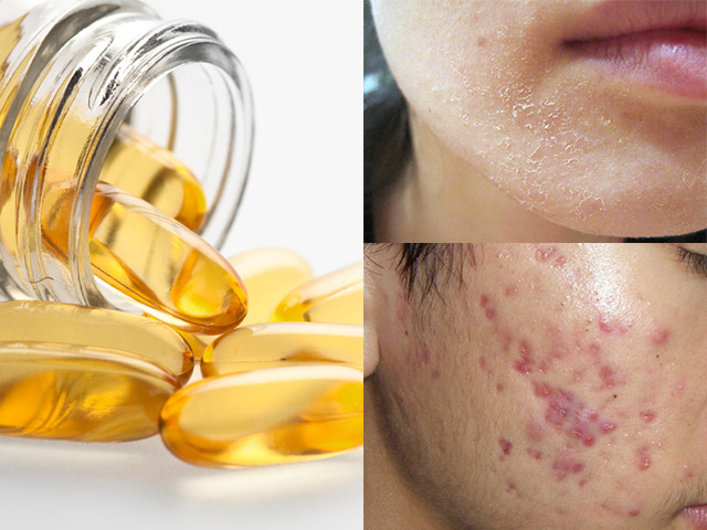 4 công dụng làm đẹp của Vitamin E nhất định bạn phải biết