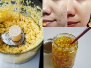 Làm đẹp - 2 cách trị sẹo thâm trên da không hề tốn kém từ nhánh gừng