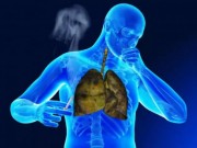 Tin tức - Căn bệnh nghệ sĩ Hán Văn Tình và ca sĩ Minh Thuận mắc phải nguy hiểm thế nào?