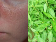 Làm đẹp - Lỗ chân lông to đến mấy cũng se khít hẳn với loại rau này