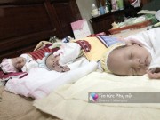 Bà bầu - Bà mẹ 19 tuổi kể về ca sinh 3 còn nguyên trong bọc ối hy hữu nhất Việt Nam