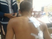 Ngày mới - Mâu thuẫn trong đám cưới, vác dao chém 3 người