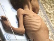 Tin tức - Bức ảnh em bé thiếu ăn, gầy trơ xương tố cáo sự thật thảm khốc ở Venezuela