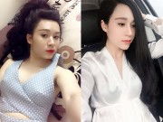 Làm đẹp - Dao kéo hỏng, hotgirl Quảng Ninh hối hận vì mặt bị đơ cứng