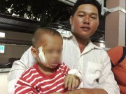 Tin tức - Cứu sống hai trường hợp bị vật đâm xuyên mặt hy hữu