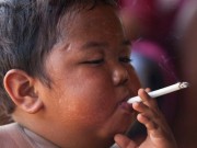 Tin tức - Sau 6 năm, cậu bé 2 tuổi hút 40 điếu thuốc một ngày giờ ra sao?