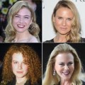 Làm đẹp - Sao Hollywood với khuôn mặt biến dạng