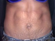 Bà bầu - Xót xa nhìn bụng mẹ nhăn nhúm sau sinh