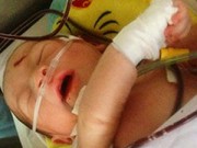 Tin tức - Bé sơ sinh văng khỏi bụng mẹ đã tự bú sữa