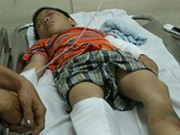 Tin tức - Bé trai 6 tuổi bị cha dượng đánh đang xuất huyết não