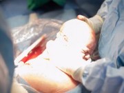 Bà bầu - Vào phòng sinh, xem từng bước 1 ca đẻ mổ