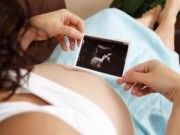 Bà bầu - Lý giải bất ngờ quanh chuyện siêu âm thai