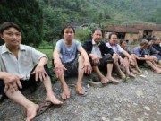Tin tức - Kỳ lạ cả làng mọc khối u, bóng nước khắp người