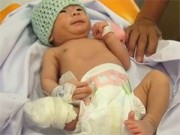 Tin tức - Bé sơ sinh văng khỏi bụng mẹ sắp xuất viện