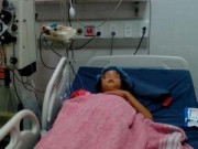 Tin tức - Bé gái bị ong vò vẽ đốt gần 170 mũi gây suy gan