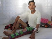 Tin tức - Heo rừng cắn nát chân hai nạn nhân