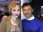 Làng sao - "Thảm họa thẩm mỹ" Hongkong lộ mặt biến dạng