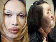 Làm đẹp - Hậu quả khôn lường vì "cuồng" phẫu thuật thẩm mỹ