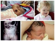 Làm mẹ - Những bé sơ sinh kỳ lạ khiến y học thế giới kinh ngạc