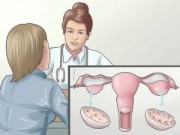 Eva Yêu - Dấu hiệu của hội chứng buồng trứng đa nang