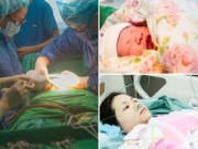 Bà bầu - Vào phòng đẻ xem trực tiếp ca sinh mổ của mẹ Việt