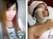 Eva Yêu - Tạt axit người yêu cũ, 'hotgirl' bị gió thổi vào mặt