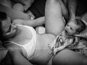 Bà bầu - "Tròn mắt" với hình ảnh em bé bị sốc khi vừa lọt lòng mẹ