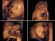 Bà bầu - Video gây choáng: Thai nhi hát trong bụng mẹ