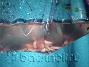 Tin tức - Hiếm gặp: Giòi lúc nhúc trong đầu bệnh nhân