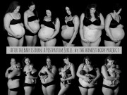 Bà bầu - Bộ ảnh khiến ai cũng xót xa về cơ thể mẹ sau sinh