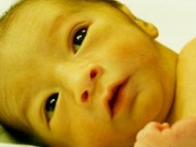 Làm mẹ - Trẻ sơ sinh bị vàng da - khi nào nên lo lắng?
