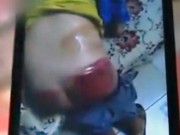 Tin tức - TQ: Học sinh lớp 4 bị thầy đánh chảy máu ướt đẫm quần