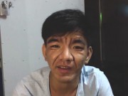 Tin tức - Kỳ lạ thanh niên 23 tuổi bỗng dưng biến thành ông lão