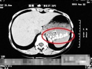 Tin tức - Hãi hùng trà sữa trân châu TQ làm từ da giày, lốp xe cũ