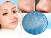 Làm đẹp - Trị tận gốc mụn đầu đen chỉ với 4 bước đơn giản mỗi ngày