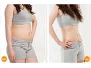 Làm đẹp - Giảm 3 cm mỡ sau 1 đêm bằng cách quấn bụng giảm béo