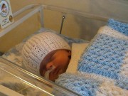 Làm mẹ - Bé sơ sinh không có não bất ngờ gọi “mẹ” sau 2 năm